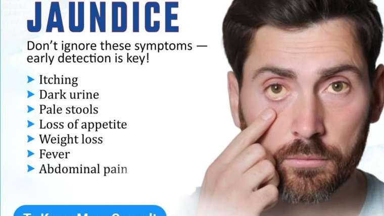 Jaundice! Causes, Signs & Treatment