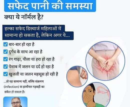Light White Vaginal Discharge Is Normal